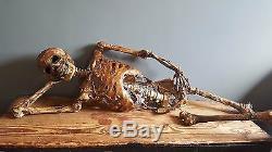 ARTIST MADE Life Size Rotting Skeleton Corpse Scary Halloween Prop Decoration